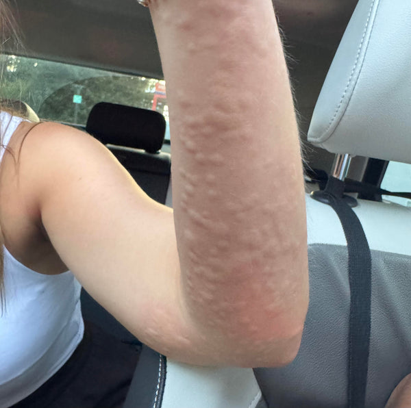 Anne, 28