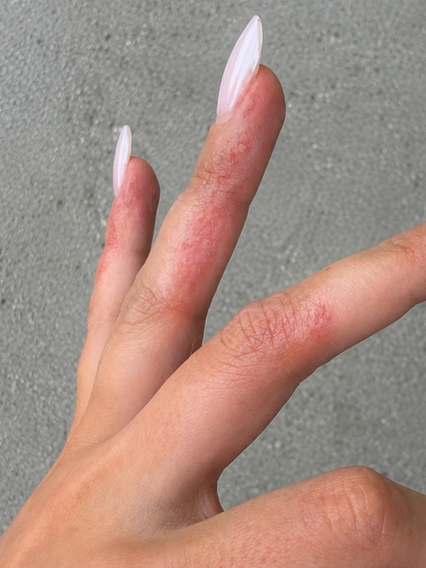 Berta, 35